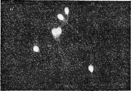 Микрофотография   люминесцирующих  сперматозоидов,  обработанных   флуорохромом аурамин  00.  Об. 20, ок. 15.