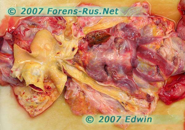 Крупные артерии шейного органокомплекса