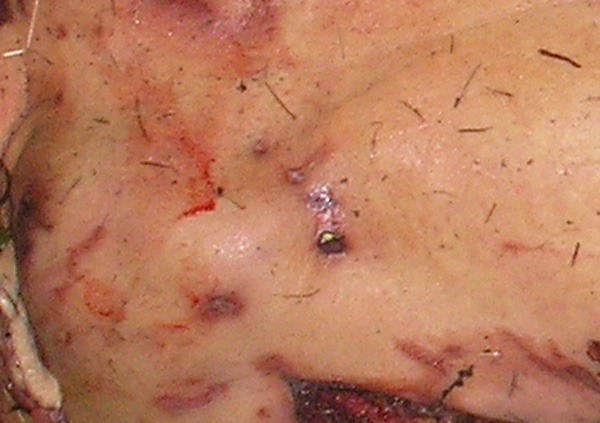 Раны от воздействия когтей на задней поверхности туловища