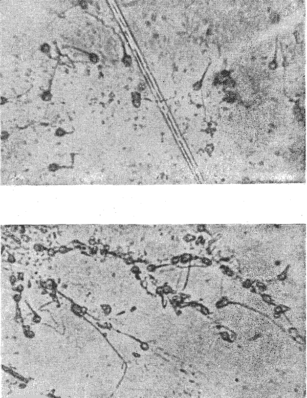 Сперматозоиды в отпечатках семенных пятен