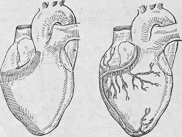 Исследование артерий на передней поверхности сердца.
